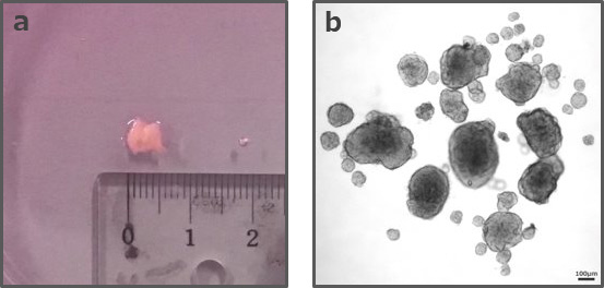 微小な患者検体から高確率で乳がんオルガノイドの作製に成功