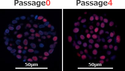 微小な患者検体から高確率で乳がんオルガノイドの作製に成功